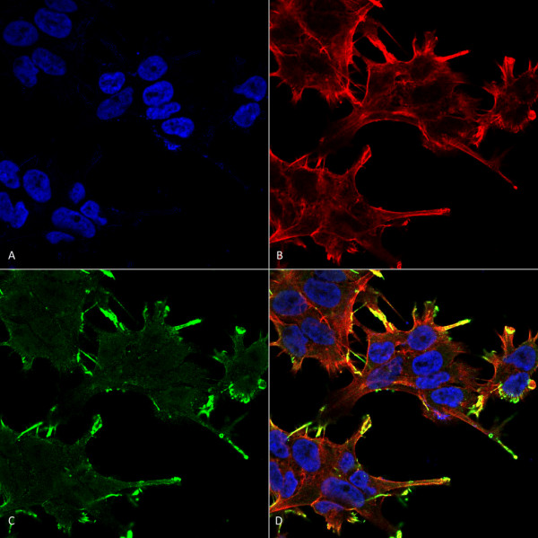Anti-Alpha B Crystallin, clone 1A7.D5