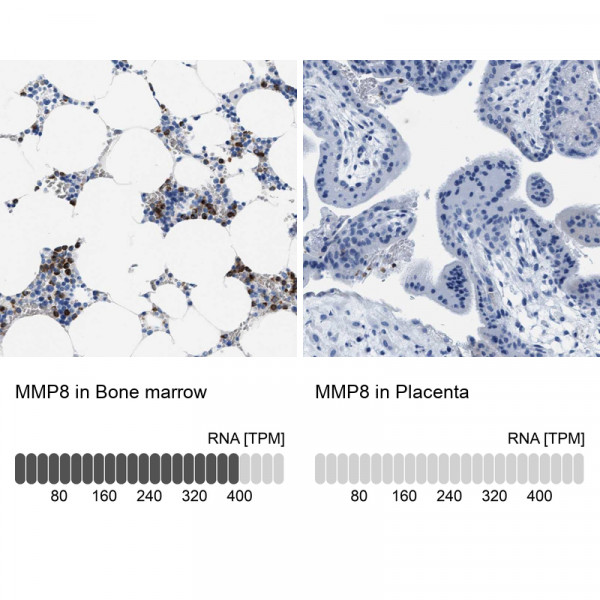 Anti-MMP8