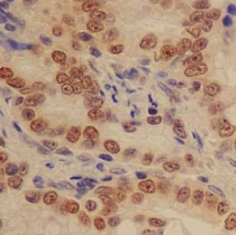 Anti-CD11b