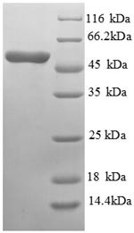 Asialoglycoprotein receptor 1 (Asgr1), partial, mouse, recombinant