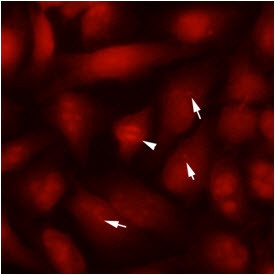 Anti-beta II Tubulin, clone 5B3