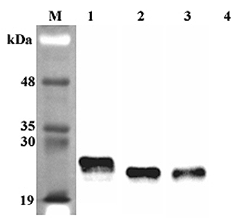 Anti-Lipocalin-2 (rat)