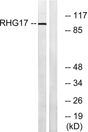 Anti-ARHGAP17