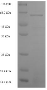S-phase kinase-associated protein 2 (SKP2), human, recombinant
