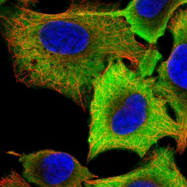 Anti-ALDH3A1