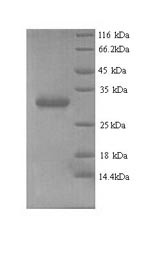 Chromobox protein homolog 7 (CBX7), human, recombinant