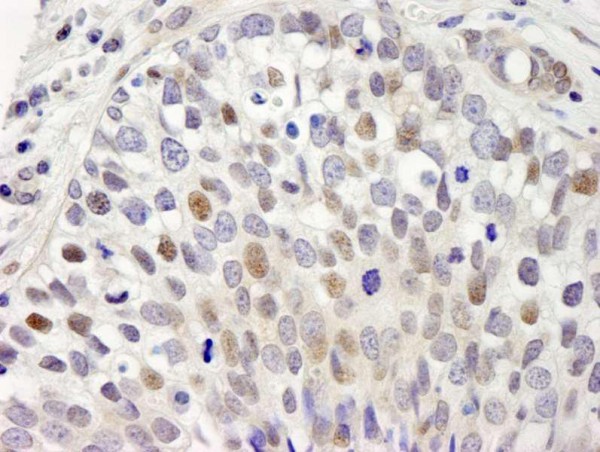 Anti-hSET1 (IHC)