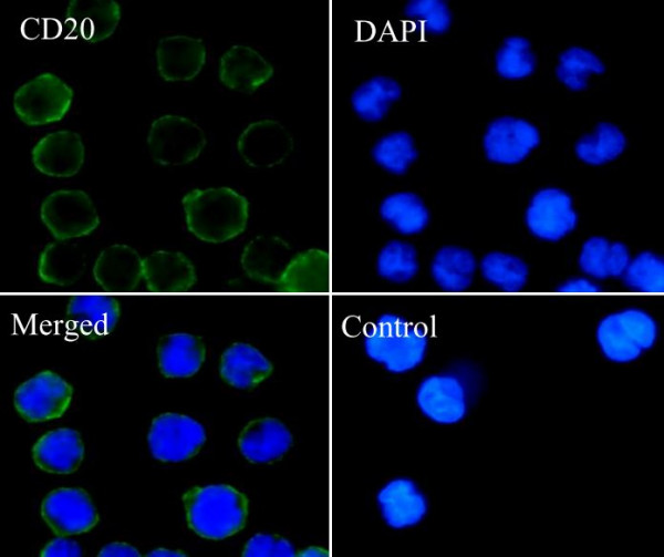 Anti-CD20, clone SQab1719