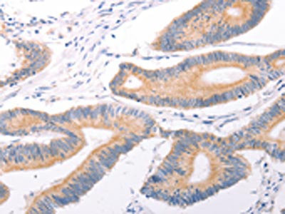 Anti-TRPC7