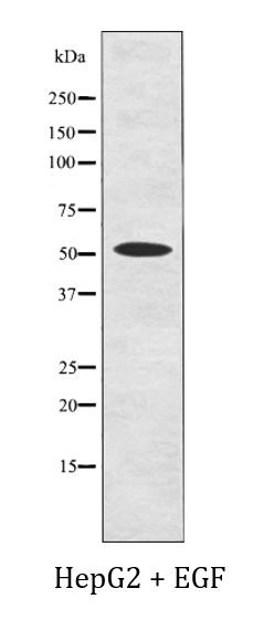 Anti-phospho-phospho-NDR1 (Thr444) + NDR2 (Thr442)