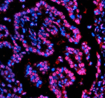 Anti-NUPR1 / Nuclear protein 1