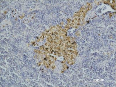 Anti-CASP8