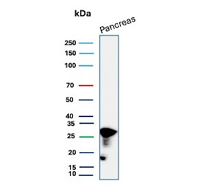 Anti-CELA3A / Chymotrypsin like elastase 3A, clone CELA3A/12553