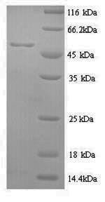 Methionine aminopeptidase 2 (METAP2), human, recombinant
