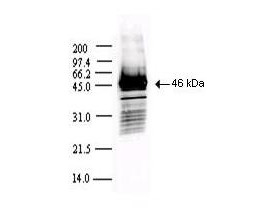 Anti-SARS-CoV Nucleocapsid (N) Protein