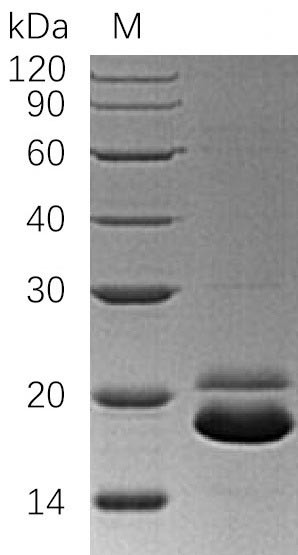 Tumor necrosis factor receptor superfamily member 10B (TNFRSF10B), partial (Active), human, recombin
