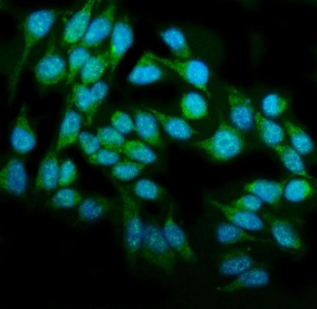 Anti-DAI / ZBP1 / Z-DNA-binding protein 1