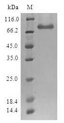 Histone-lysine N-methyltransferase SETDB1 (SETDB1), human, recombinant