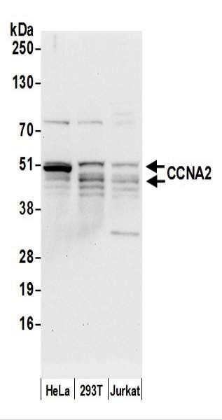 Anti-CCNA2/Cyclin A2