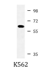 Anti-Catalase, clone 626CT4.3.8