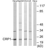Anti-CSRP1