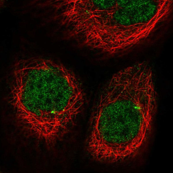 Anti-CDKL2