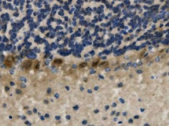 Anti-LHX1 / LIM-1