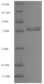 Lymphotoxin-beta (LTB), partial, Pan troglodytes, recombinant