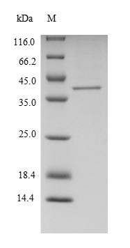 Putative ribosomal RNA methyltransferase 1 (FTSJ1), human, recombinant