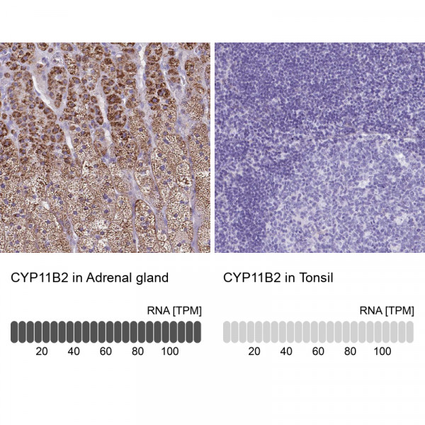 Anti-CYP11B2
