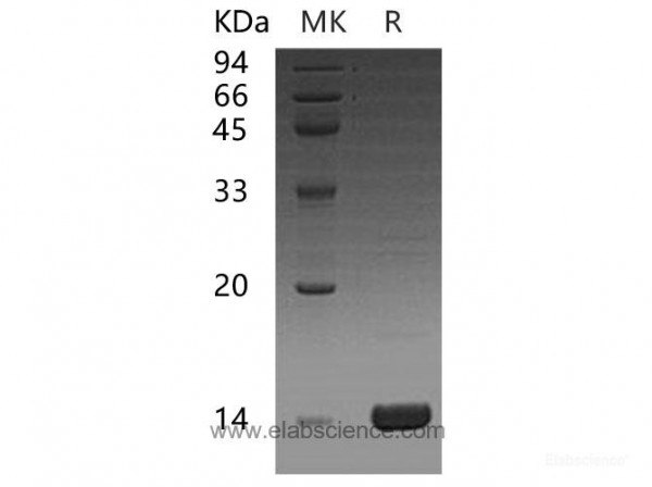 C-C Motif Chemokine 16/CCL16 Protein (recombinant human)