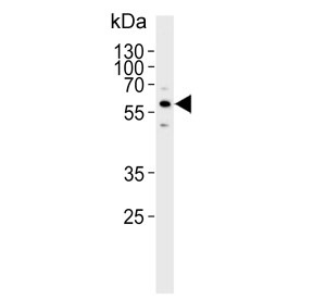 Anti-Cytochrome P450 3A5 / CYP3A5