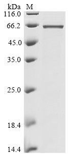 Nucleoprotein (N), Bat coronavirus HKU9, recombinant