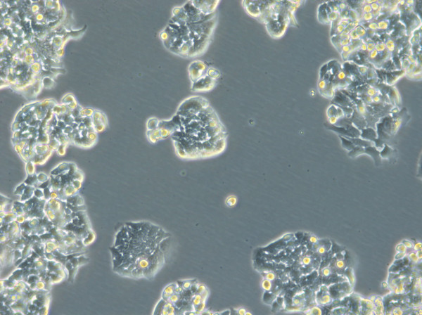 HROC257 Cells