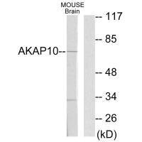 Anti-AKAP10