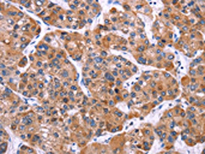 Anti-MSMO1