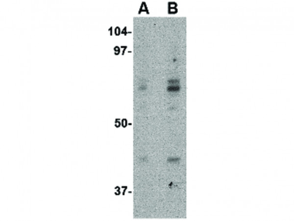 Anti-ATG16