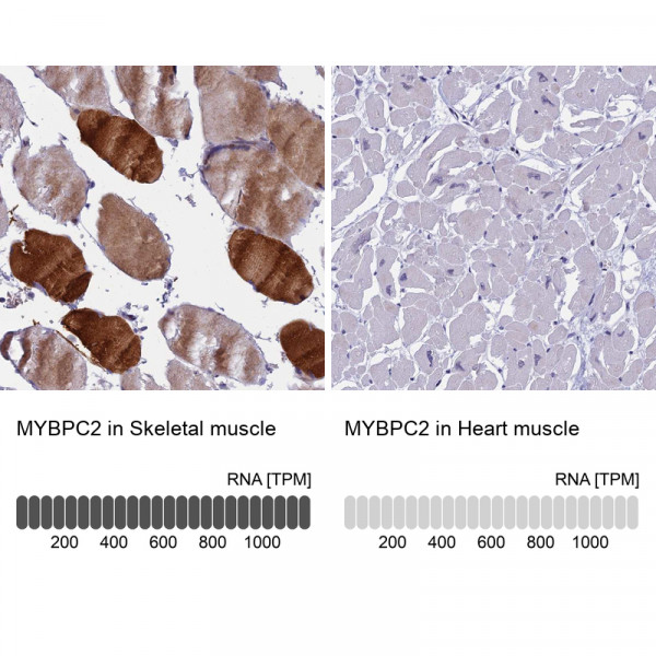 Anti-MYBPC2