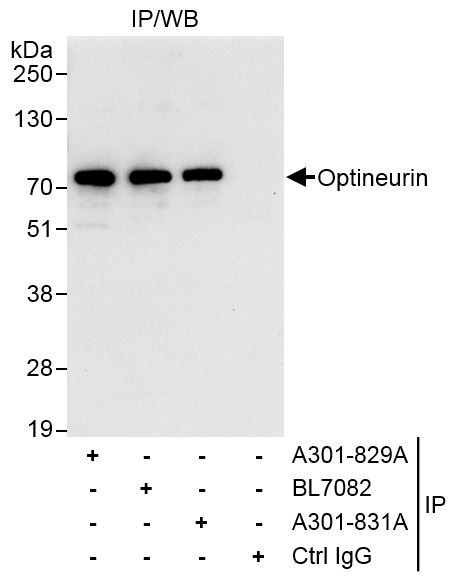 Anti-Optineurin