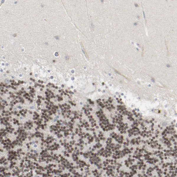 Anti-NEUROD1