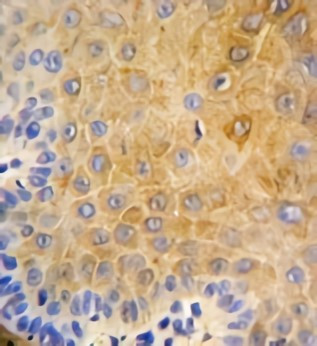 Anti-Cytokeratin 9