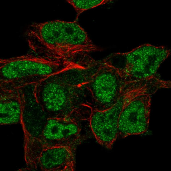 Anti-CSPG5