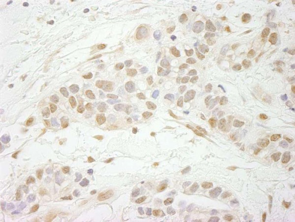 Anti-MTA3 (IHC)