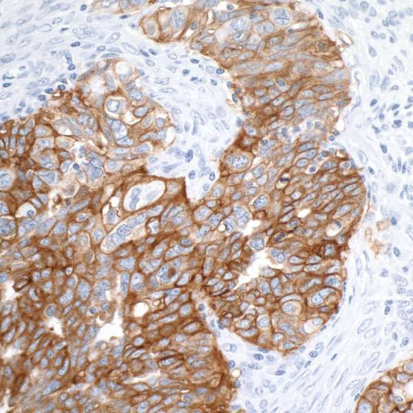 Anti-EpCAM Recombinant Monoclonal