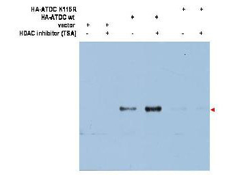 Anti-acetyl-TRIM29 (ATDC Ac-K116)