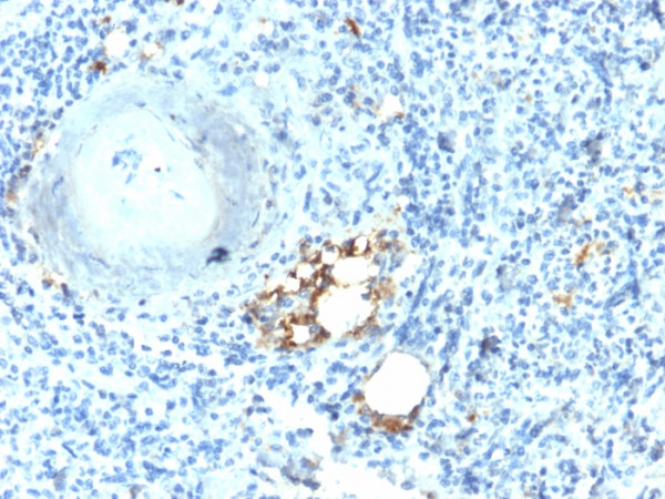 Anti-TRAcP (Tartrate-Resistant Acid Phosphatase) (Hairy Cell Leukemia Marker), recombinant antibody,