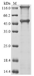 Melanoma-associated antigen 12 (MAGEA12), human, recombinant