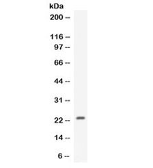 Anti-CNTF / Ciliary Neurotrophic Factor