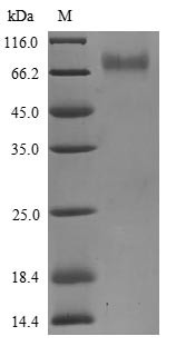 Killer cell immunoglobulin-like receptor 2DS3 (KIR2DS3), partial, human, recombinant