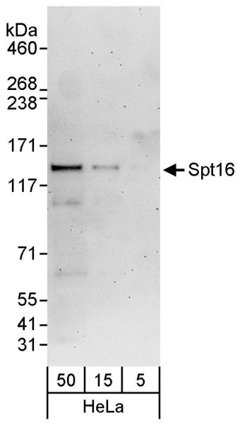 Anti-Spt16